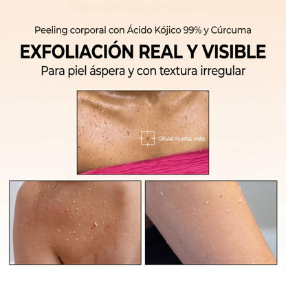 PurelyHale Glow Renove — Spray Exfoliante Corporal Ácido Kójico 99% y Cúrcuma 200ml
