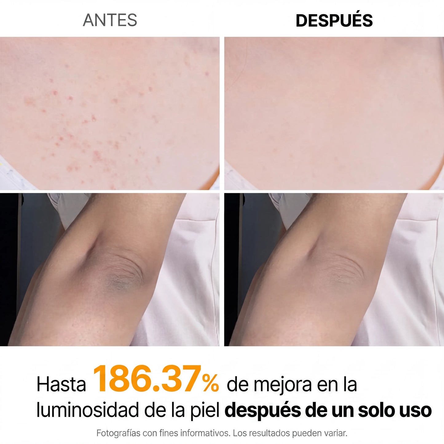 PurelyHale Glow Renove — Spray Exfoliante Corporal Ácido Kójico 99% y Cúrcuma 200ml