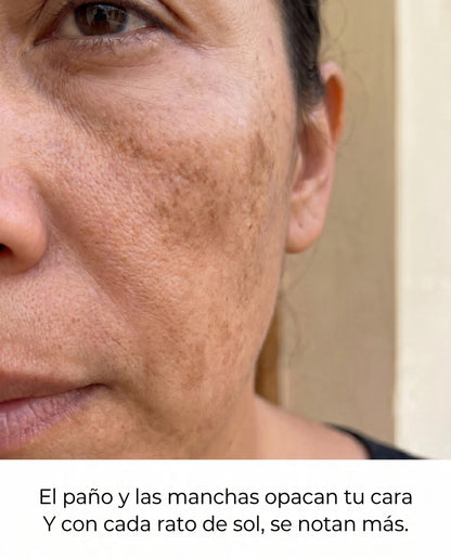 PurelyHale Tono Perfecto — Arbutin 7% + TXA 4% Cream Crema correctora de manchas y paño · Doble activo